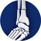 Trauma & Fractures